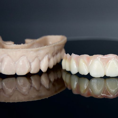 3D Printed Invisalign Shells