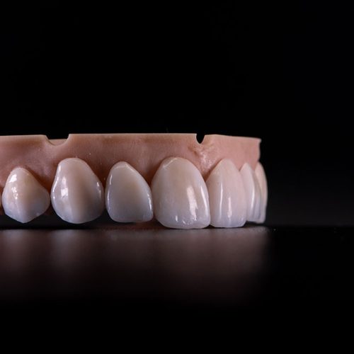 3D Printed Restorations