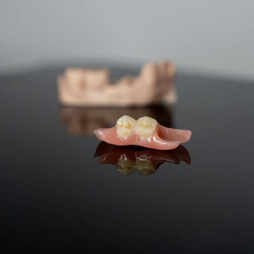 3D Printed Temporary Denture